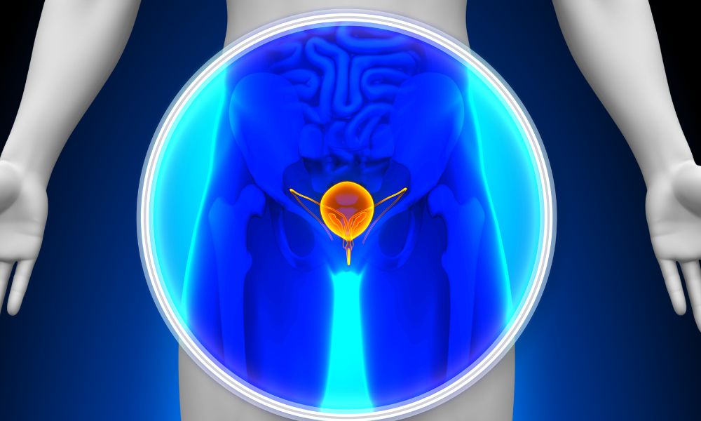 Causas De La Vejiga Neurogénica