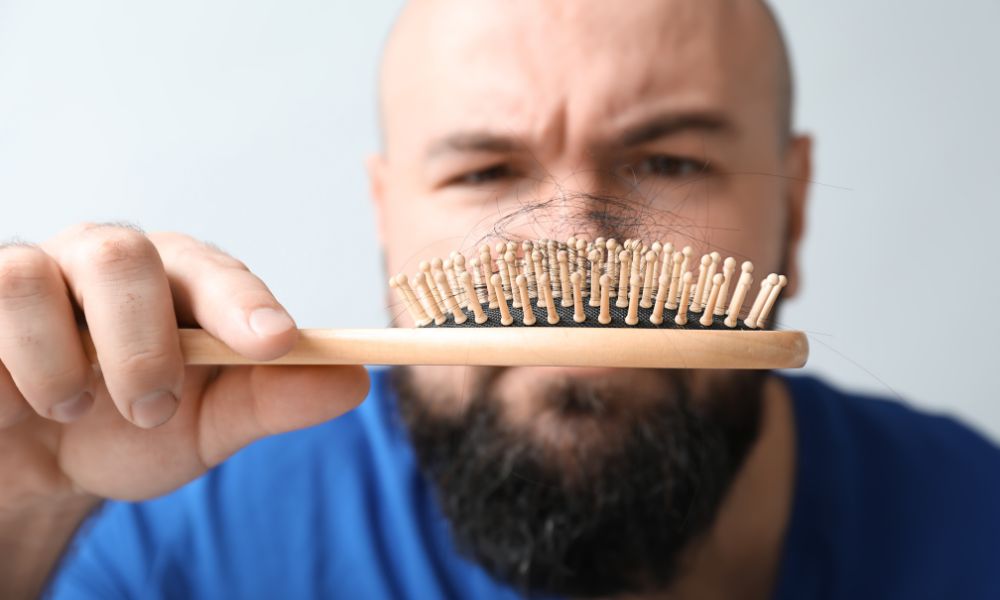 La Relación Entre La Testosterona Y La Caída Del Cabello